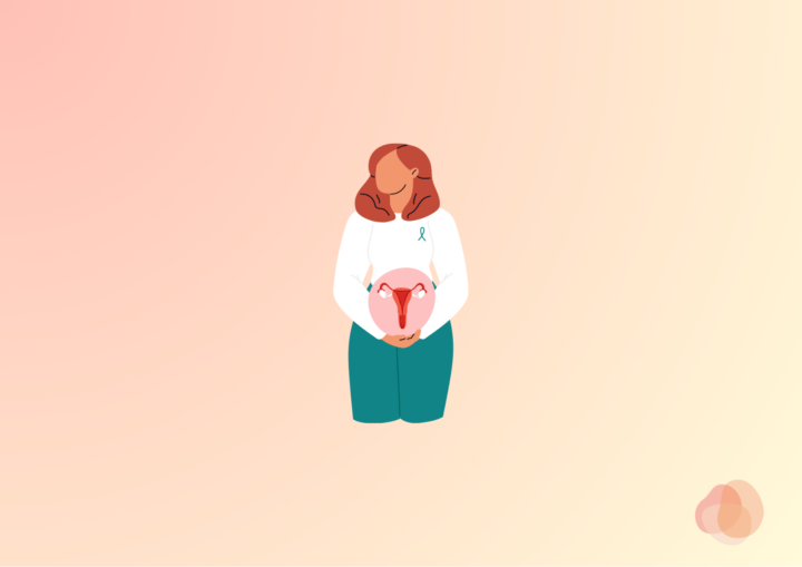 子宮がん検診の画像