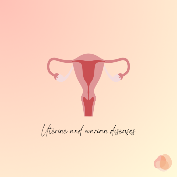 子宮・卵巣の疾患の画像